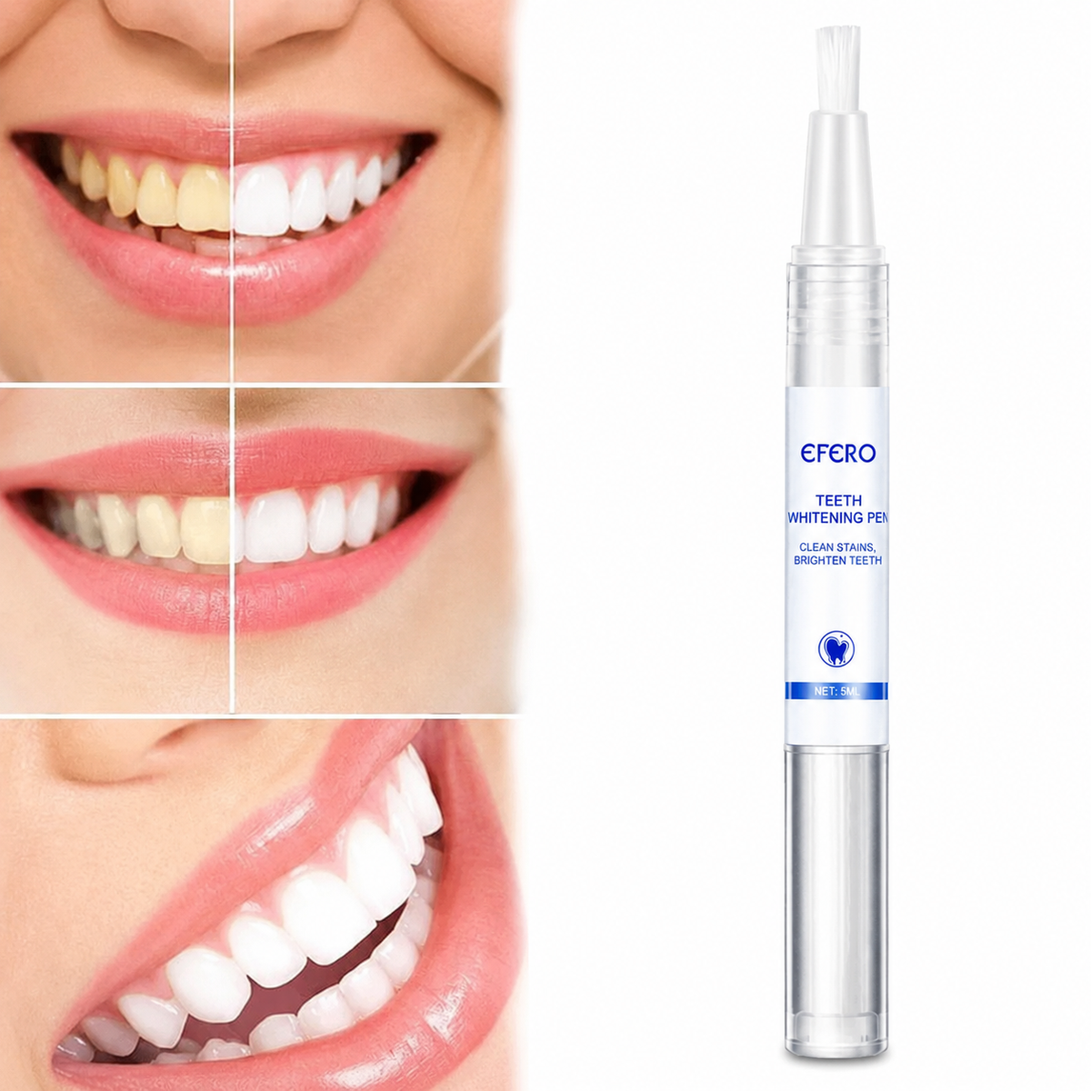 🦷✨ SONRÍE CON CONFIANZA Y LUCE UNA SONRISA MÁS BLANCA